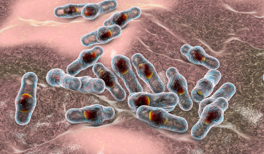 Gangrene: What Is, Causes, Symptoms, and Treatment