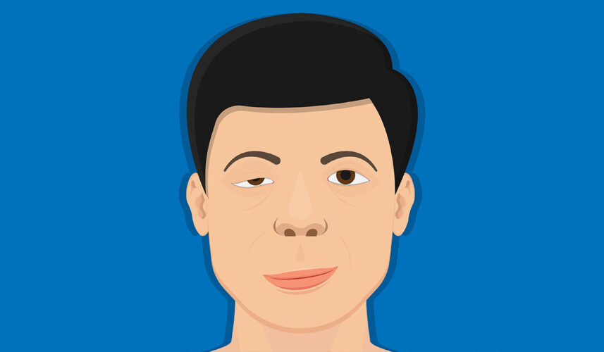 Myasthenia Gravis: What Is, Symptoms, Diagnosis, Treatment, and Prognosis