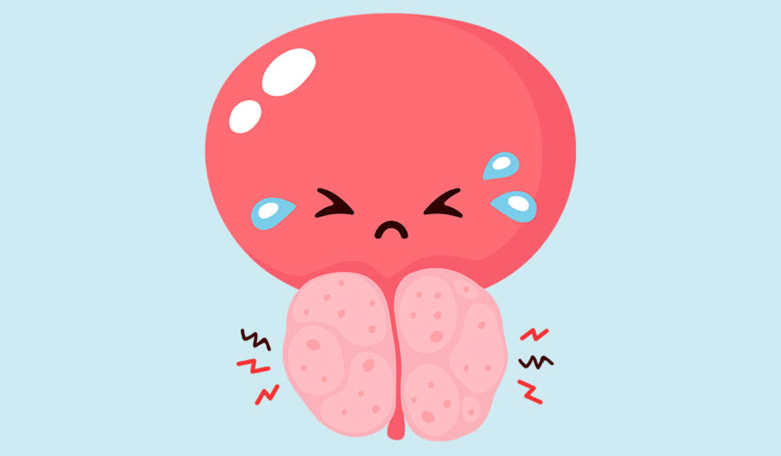 Prostatitis: What Is, Causes, Symptoms, Diagnosis, and Treatment