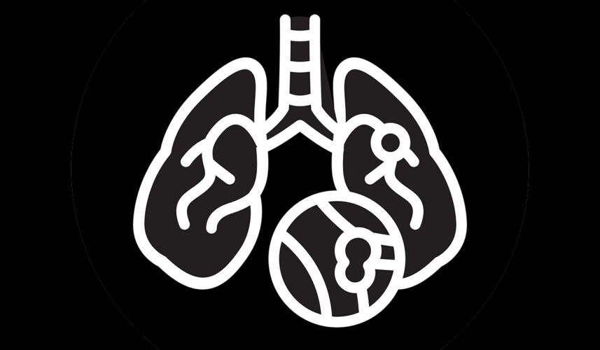 Pulmonary Embolism: What Is, Causes, Symptoms, and Diagnosis