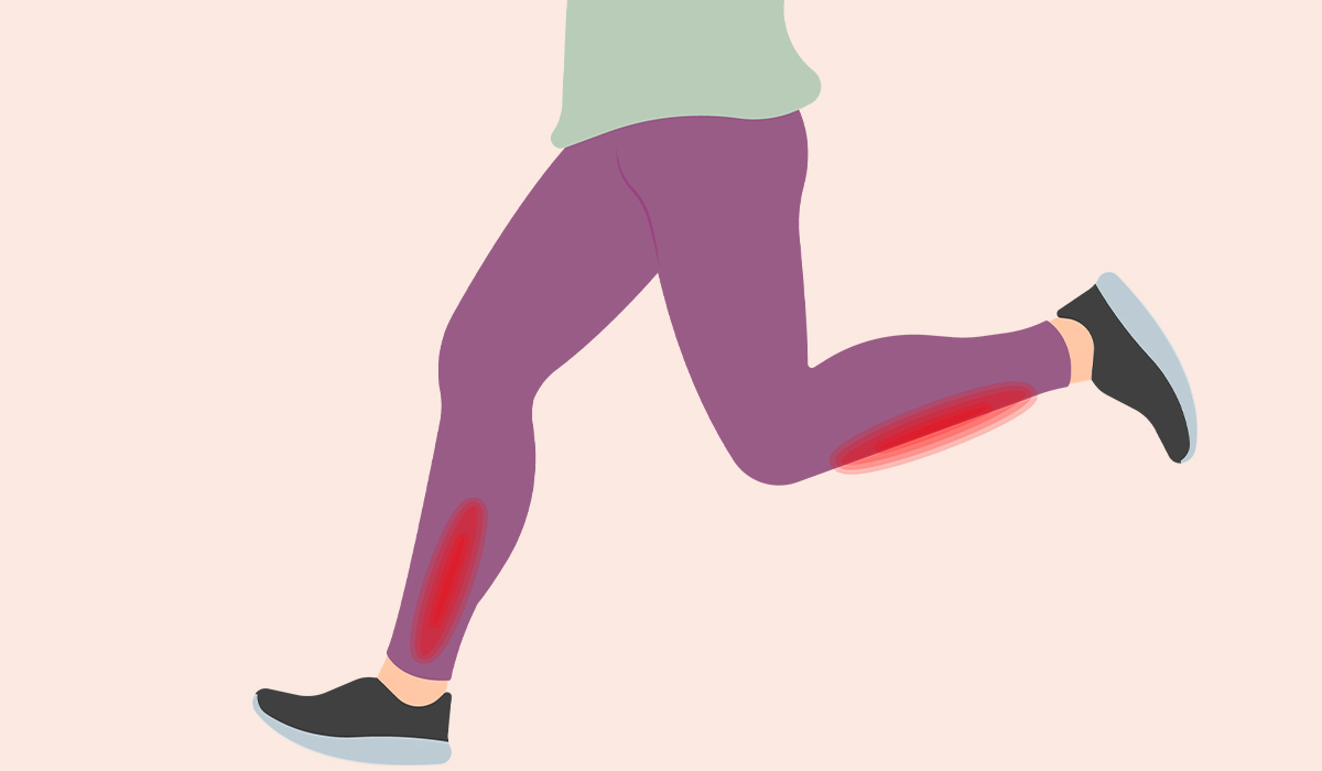 Shin Splints: What Are, Causes, Symptoms, Treatment, and Prevention