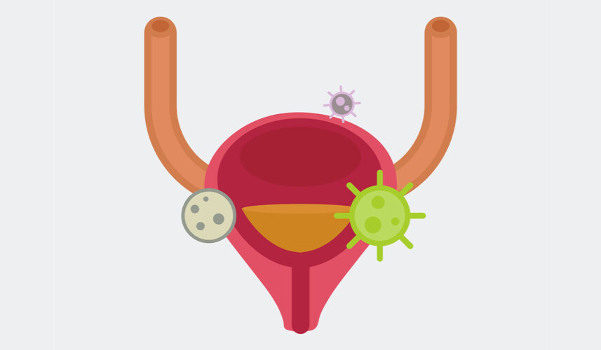 Bladder Infection: What Is, Causes, Symptoms, and Diagnosis