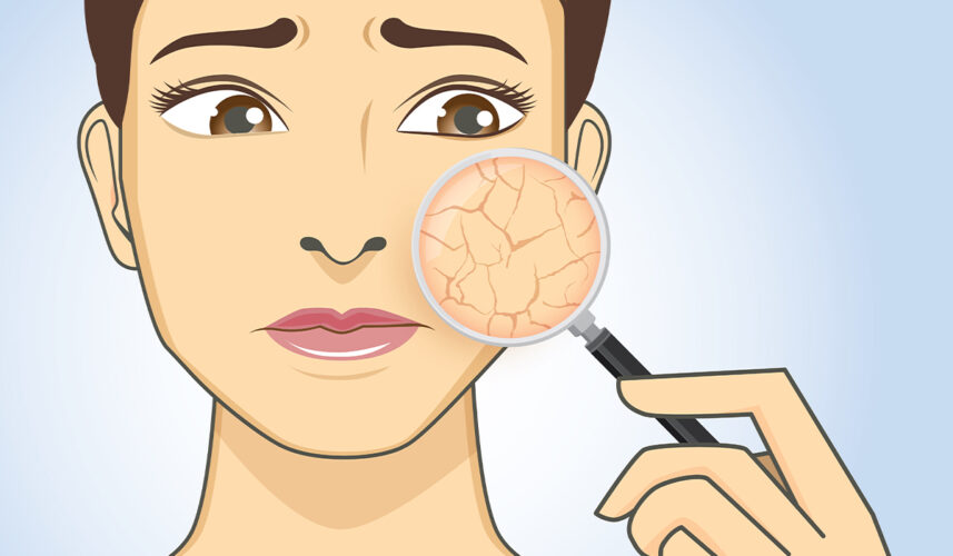Dry Skin: What Is, Causes, Symptoms, and Treatment
