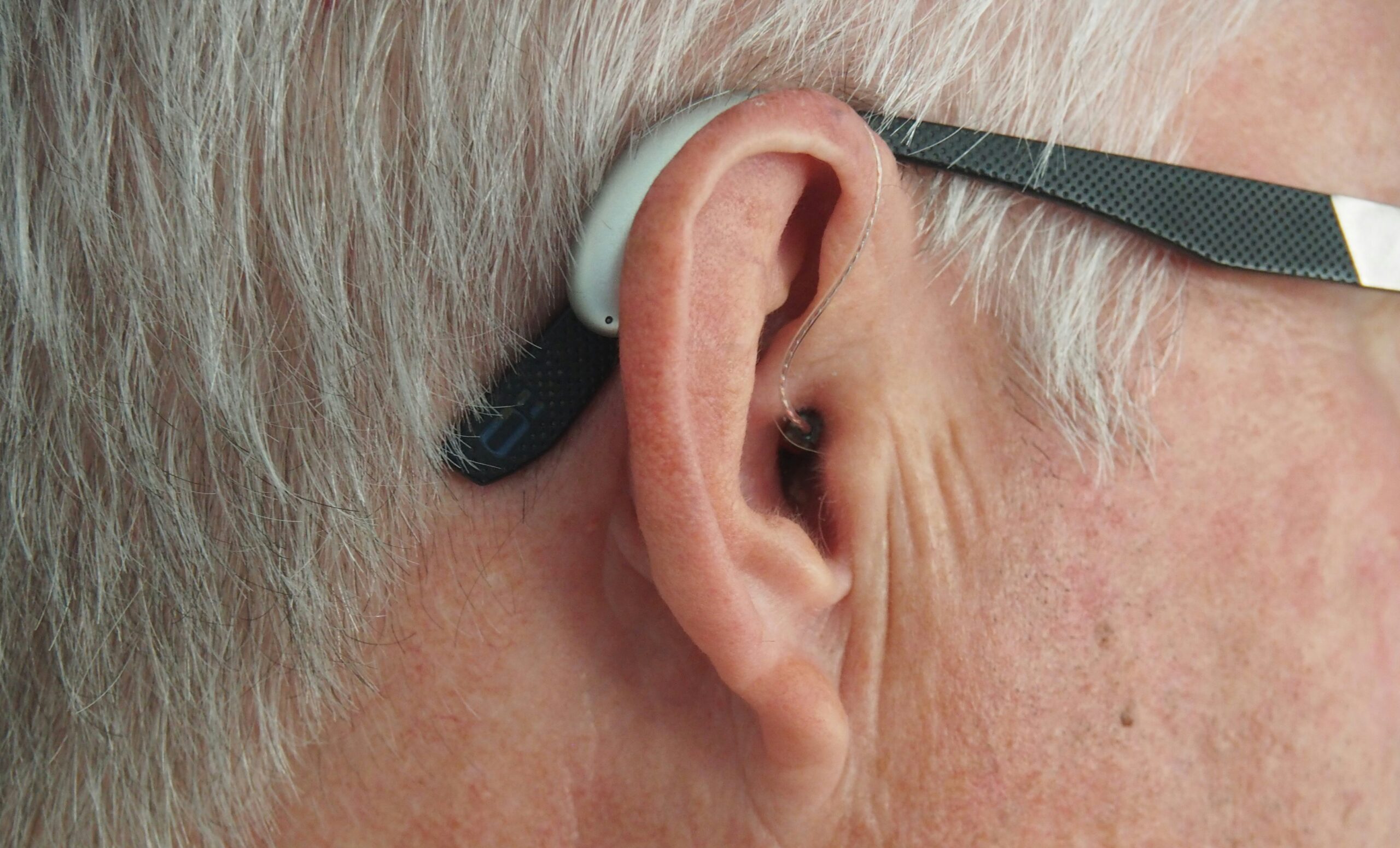 Hearing Loss: What Is, Types, Causes, and Diagnosis