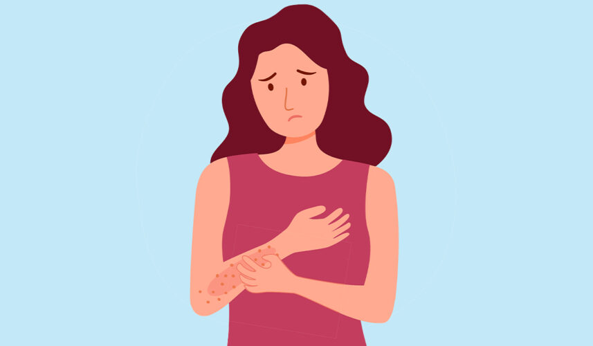 Itchy Skin: What Is, Causes, Diagnosis, and Treatment