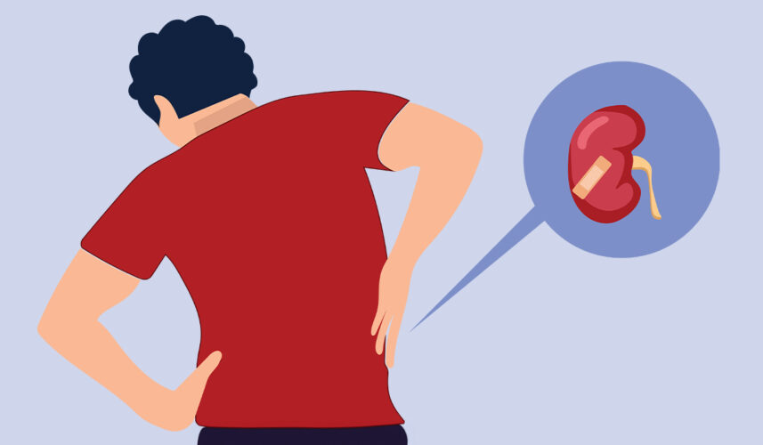 Kidney Pain: What Is, Symptoms, Complications, and Treatment