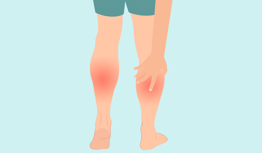 Muscle Strain: What Is, Causes, Symptoms, and Treatment