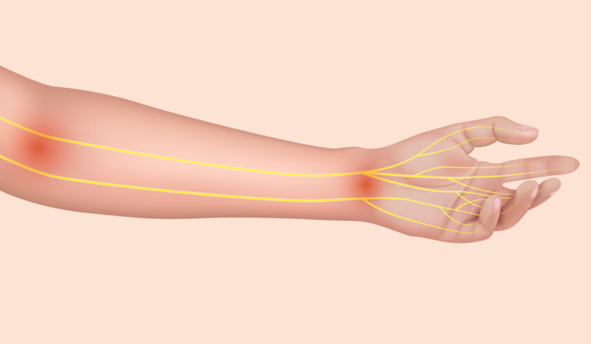 Nerve Pain: What Is, Symptoms, Diagnosis, and Treatment