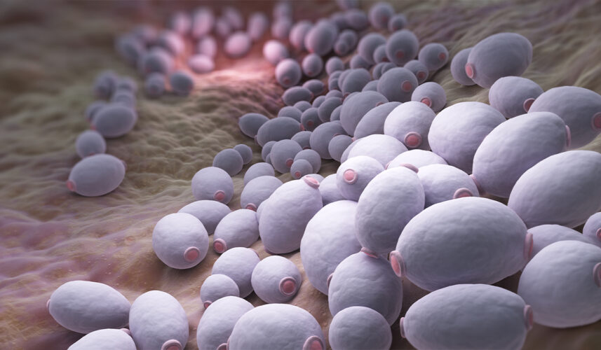 Yeast Infection: What Is, Types, Diagnosis, and Treatment