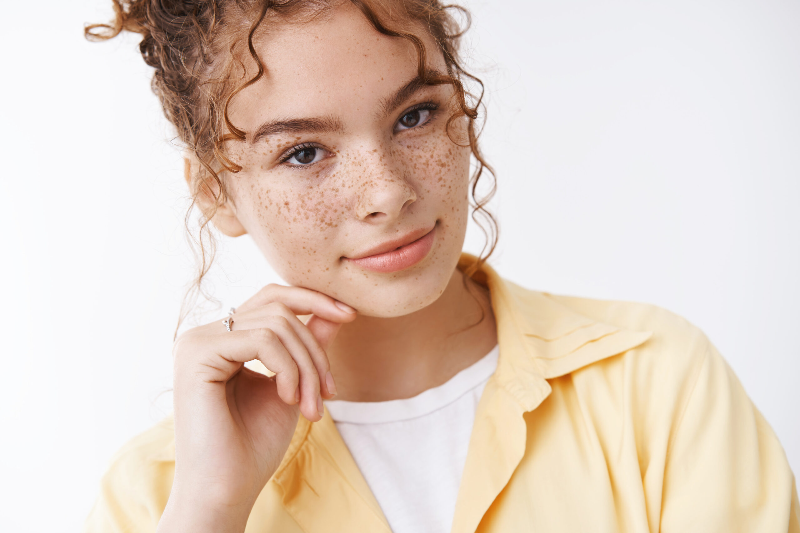 Freckles: What Are, Causes, Formation, and Removal