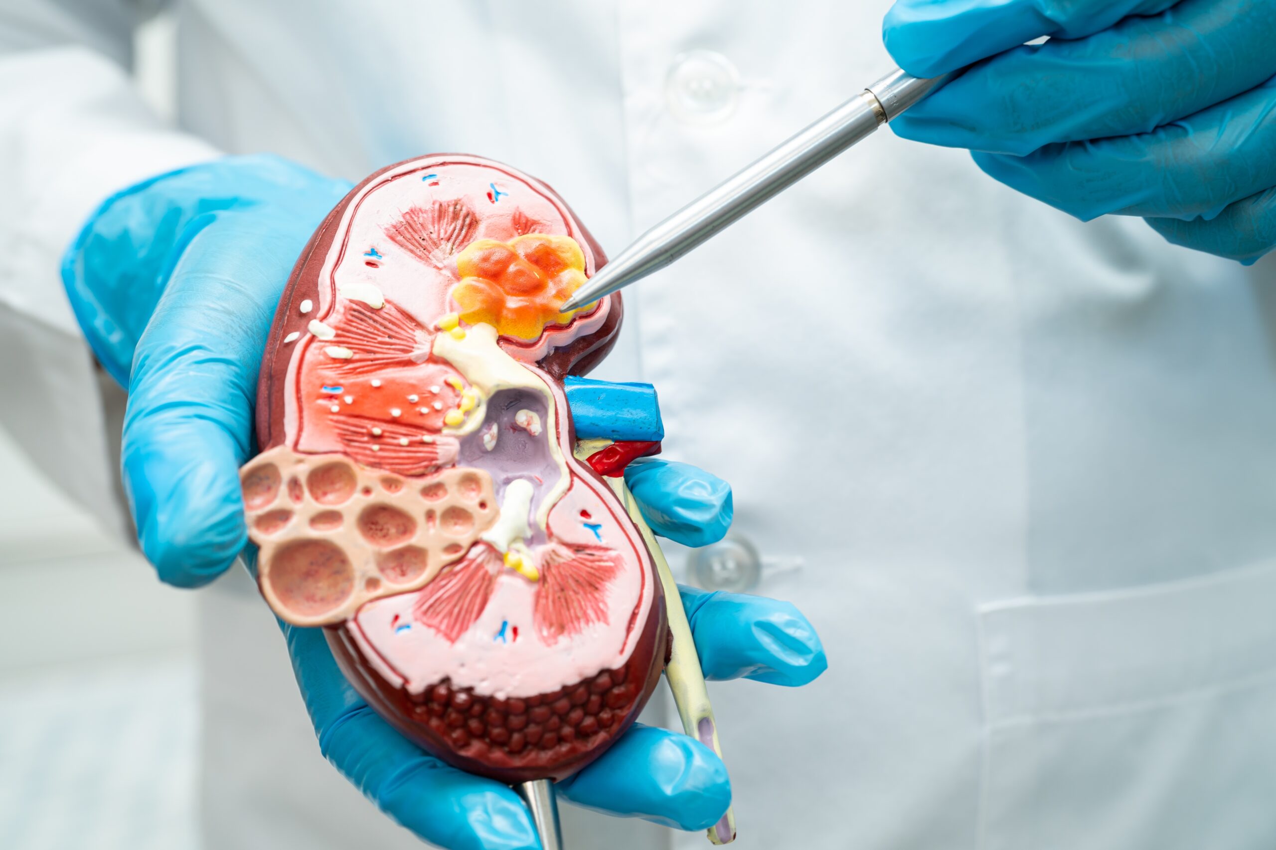 Kidney: What Is, Functions, Location, Anatomy, Conditions, and Health