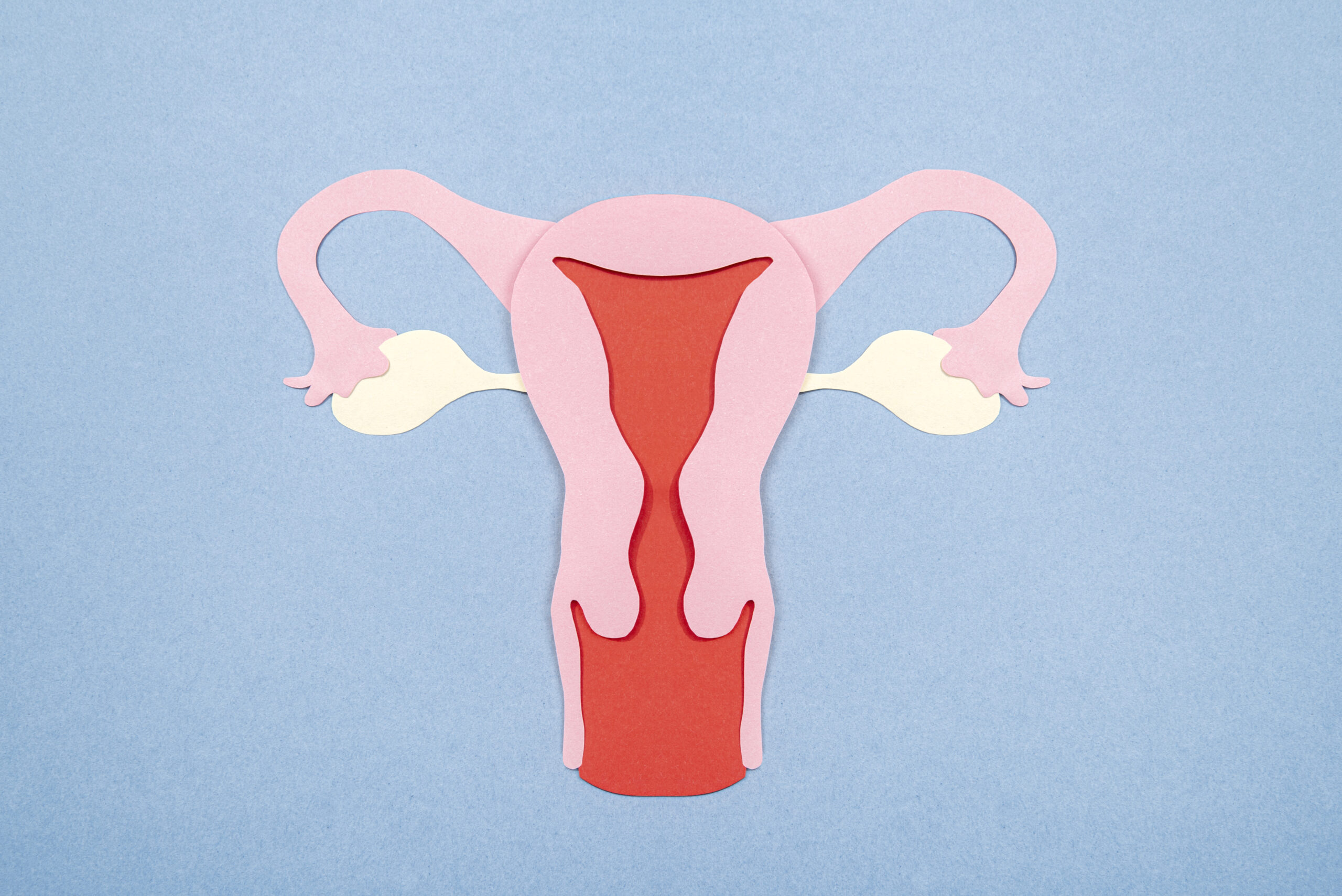 Ovarian Cancer: What Is, Causes, Symptoms, and Diagnosis