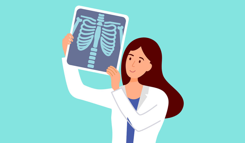 Rib Pain: What Is, Causes, Diagnosis, and Treatment