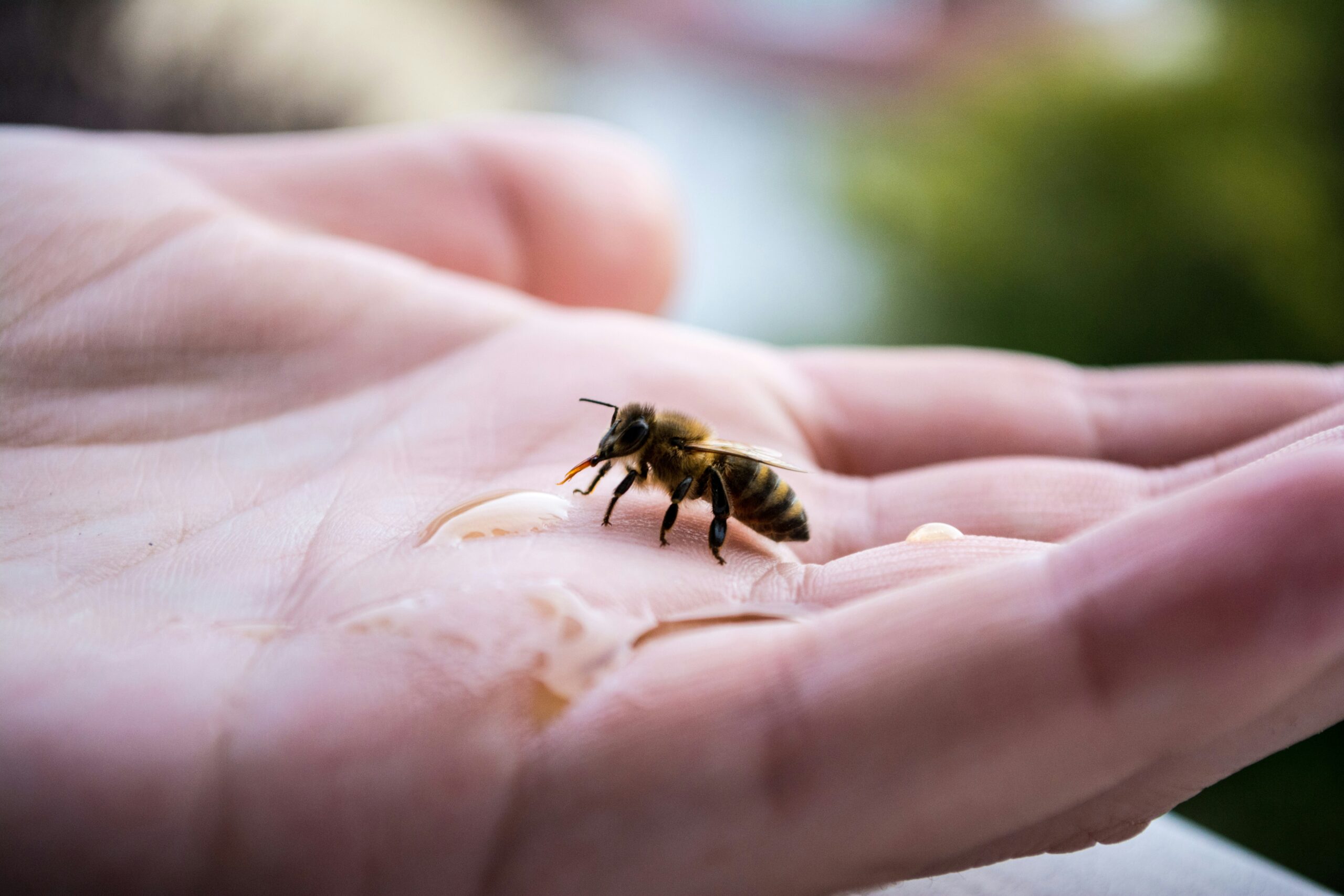 Bee Sting: What Is, Causes, Diagnosis, and Treatment