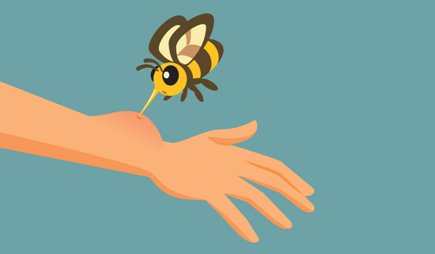 Bee Sting: What Is, Causes, Diagnosis, and Treatment
