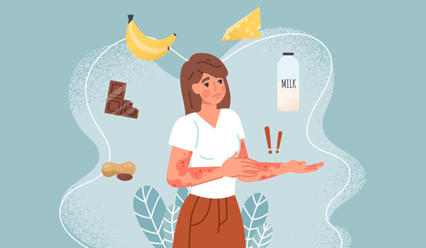 Food Allergy: What Is, Causes, Epidemiology, Symptoms, and Treatment