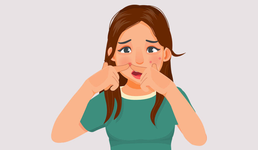 Pimples: What Are, Types, Causes, and Diagnosis