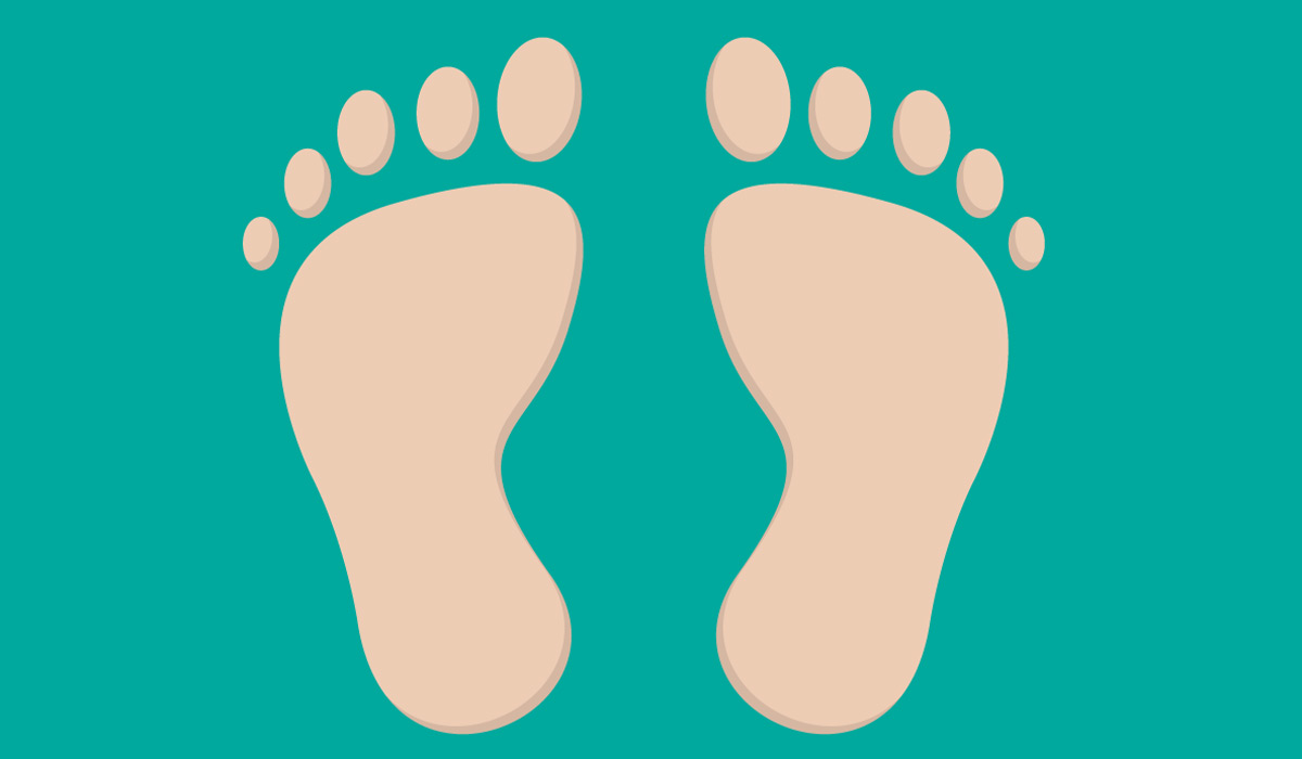 Flat Feet