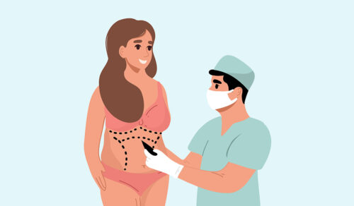 Liposuction