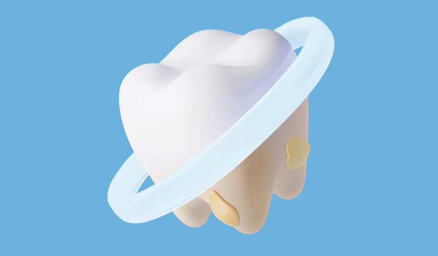 Teeth Whitening: What Is, Advantages, and Disadvantages