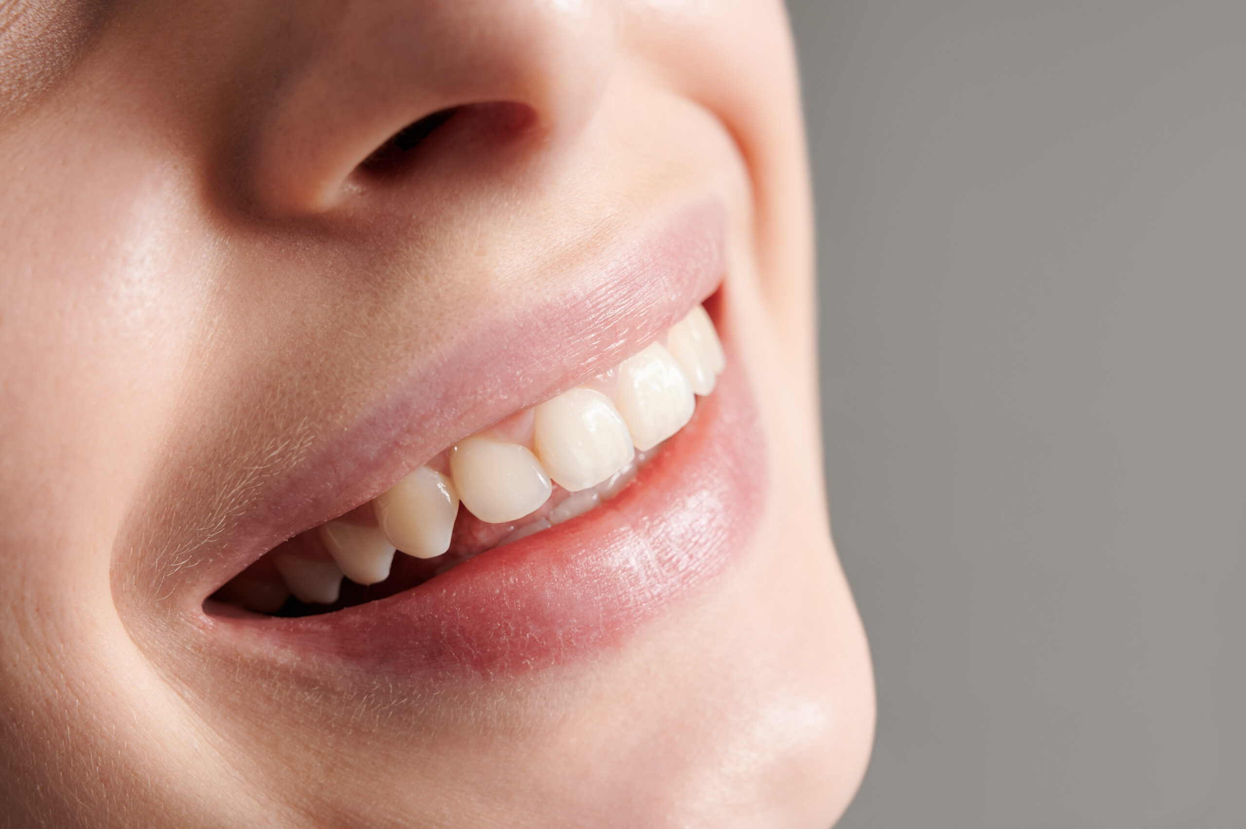 Teeth Whitening: What Is, Advantages, and Disadvantages