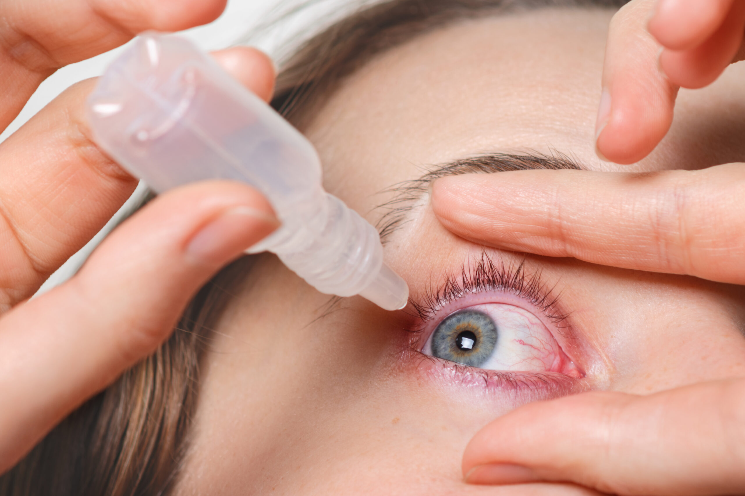 Eye Drops: What Are, Composition, and How They Work