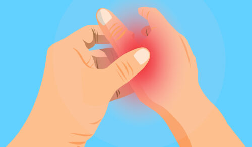 Finger Pain