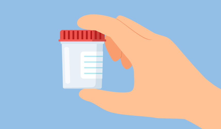Hematuria: What Is, Causes, Methods of Diagnosing, and Treatment