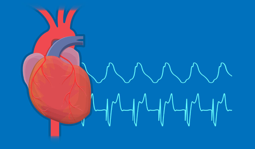 POTS: What Is, Complications, Diagnosis, and Symptoms