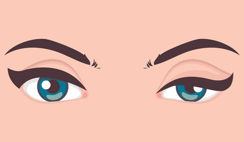 Eyelid: What Is, Anatomy, Common Diseases, and Treatment of Issues