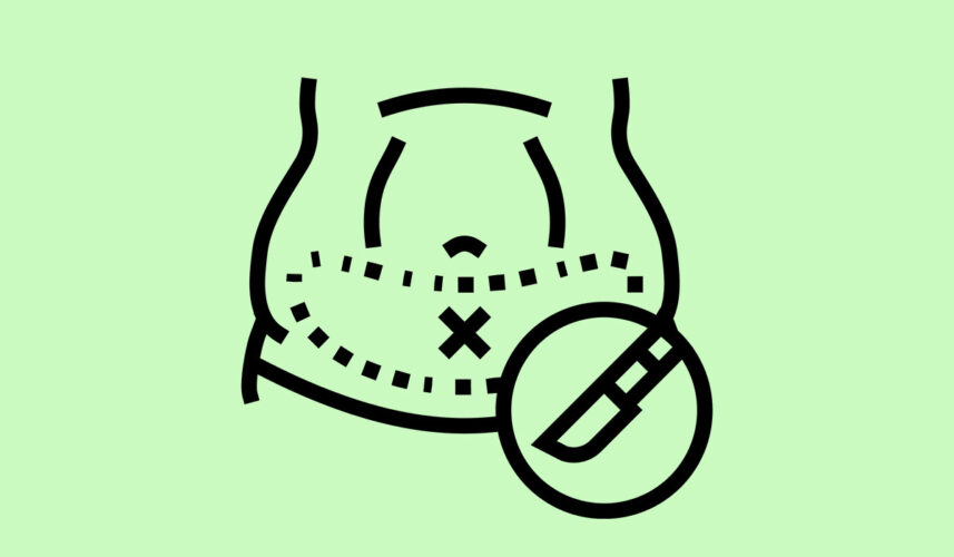 Tummy Tuck: What Is, Procedure, Indications, and Contraindications