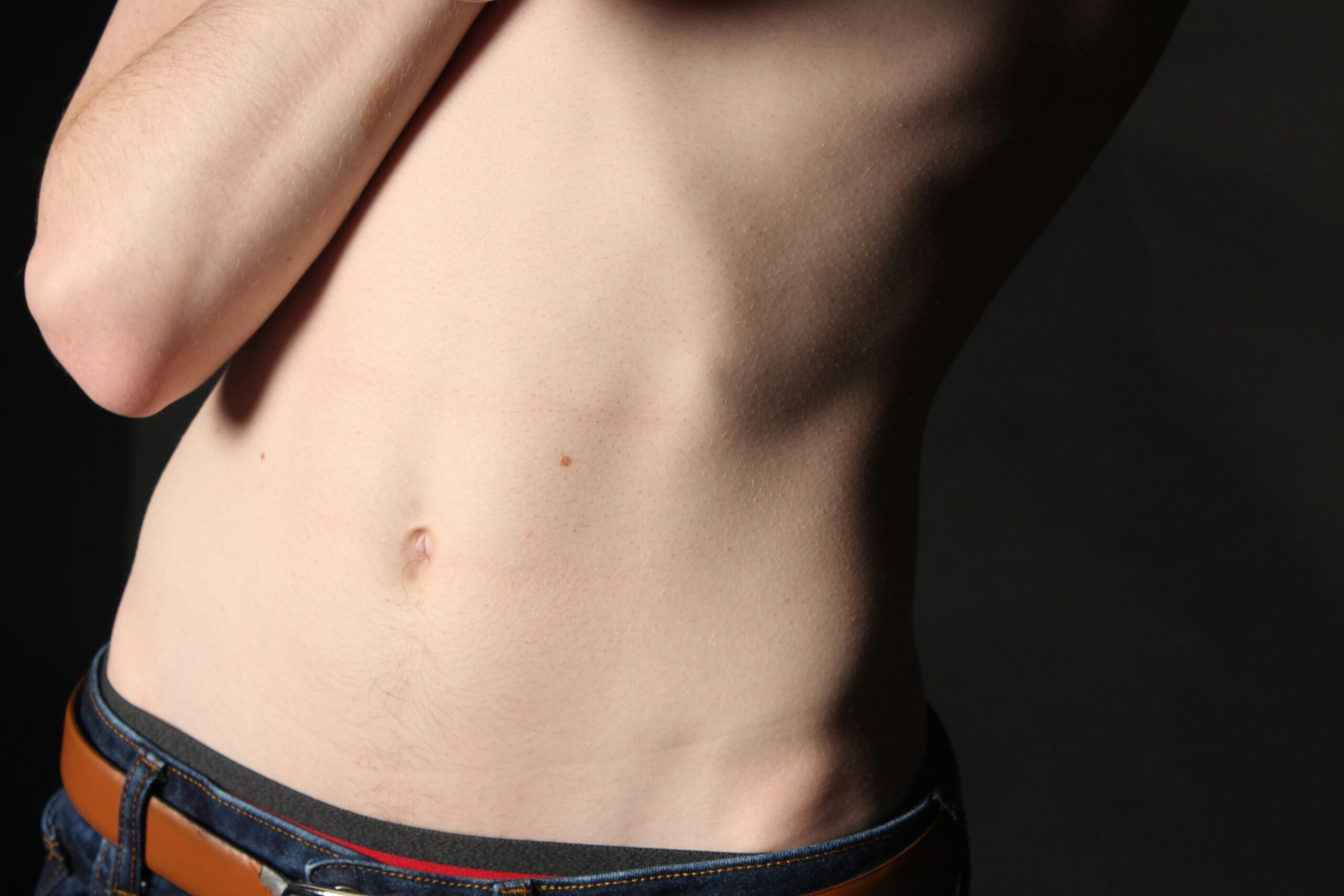 Tummy Tuck: What Is, Procedure, Indications, and Contraindications