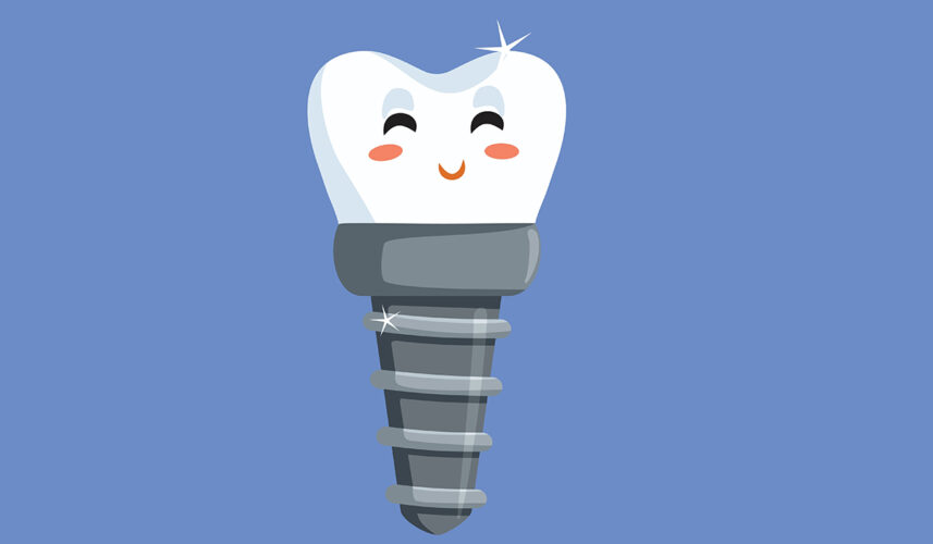 Dental Implants: What Are, Types, Applications, and Benefits