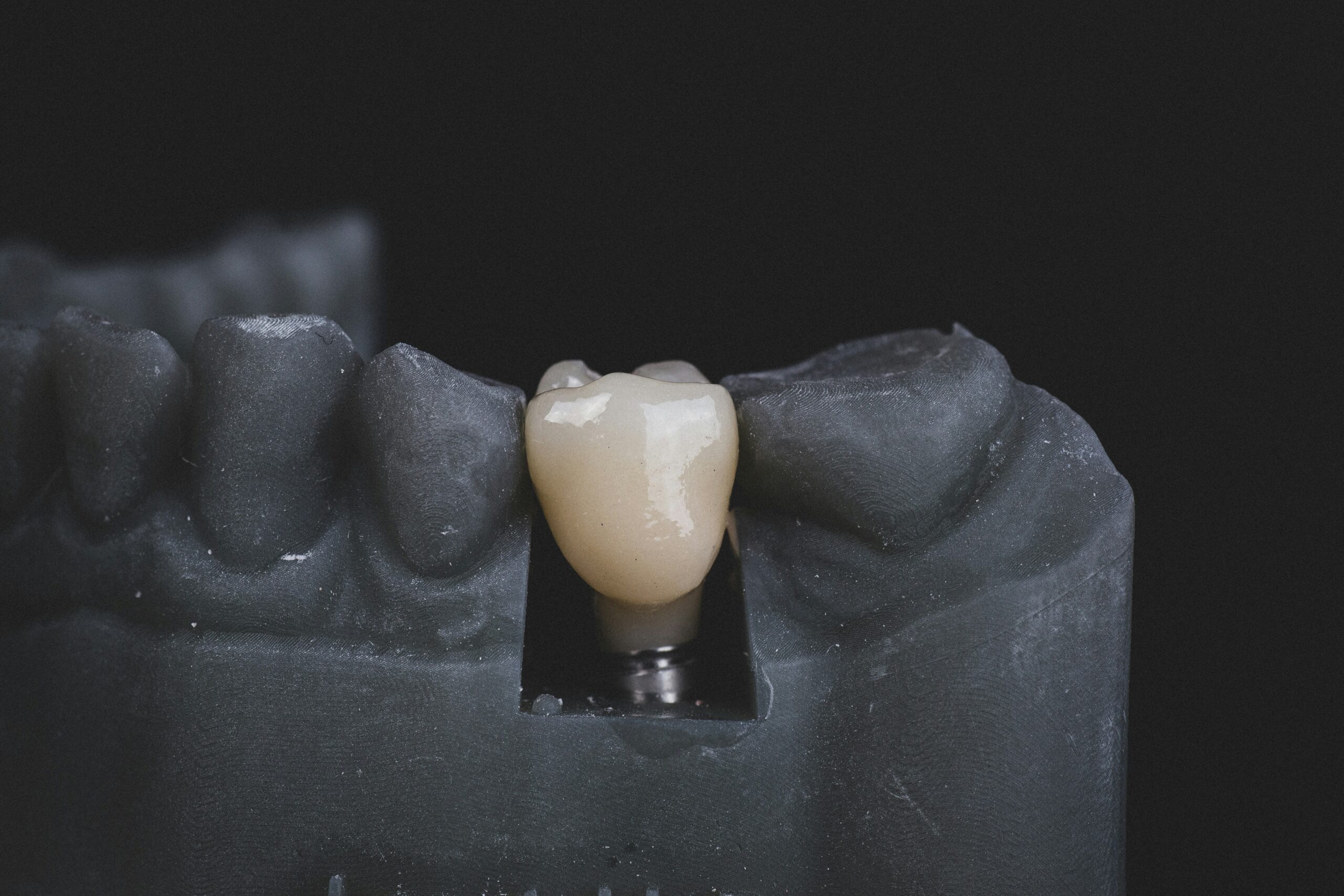 Dental Implants: What Are, Types, Applications, and Benefits