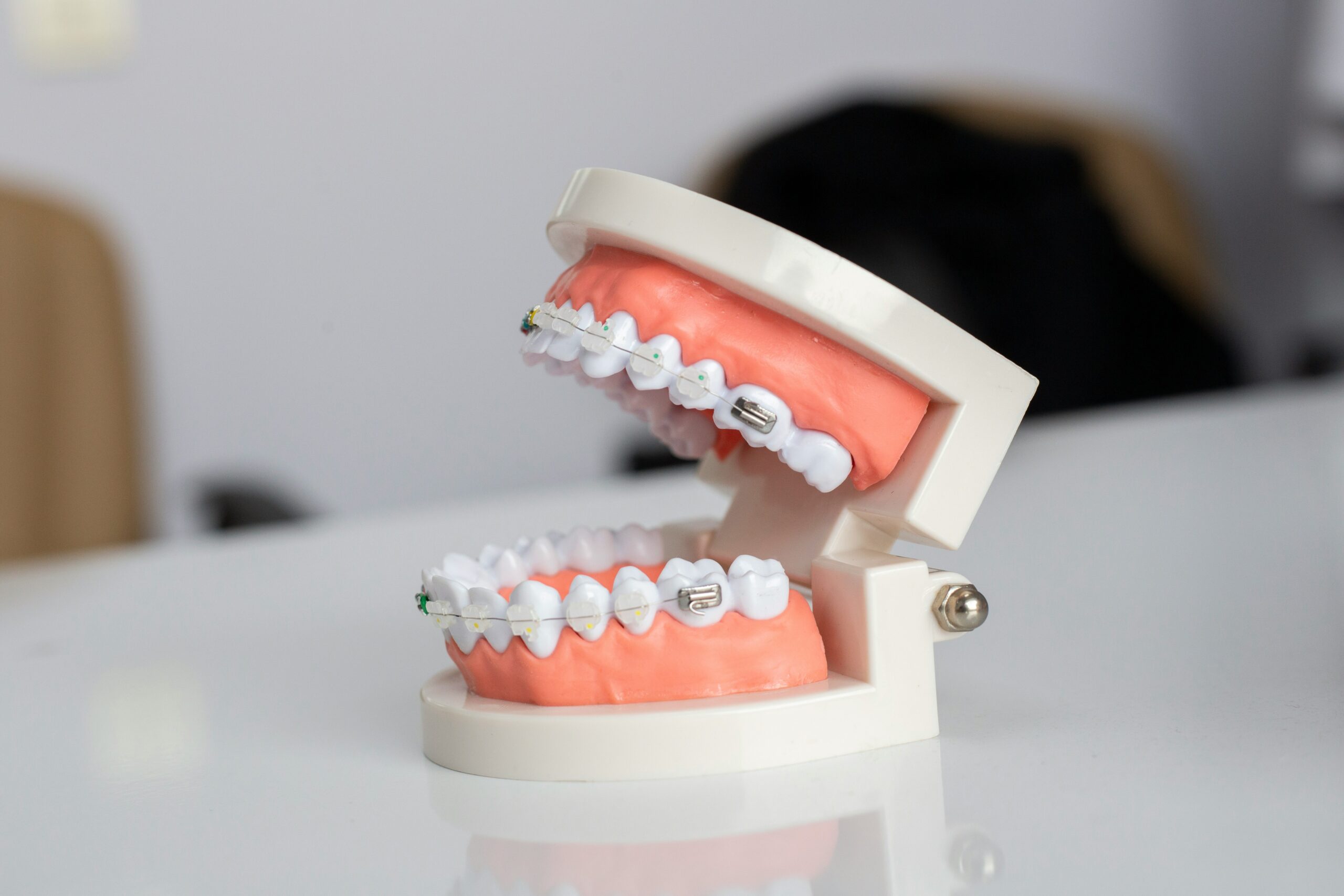 Dental Implants: What Are, Types, Applications, and Benefits