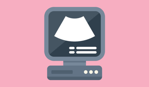Echocardiogram: What Is, Methods, Preparation, Procedure